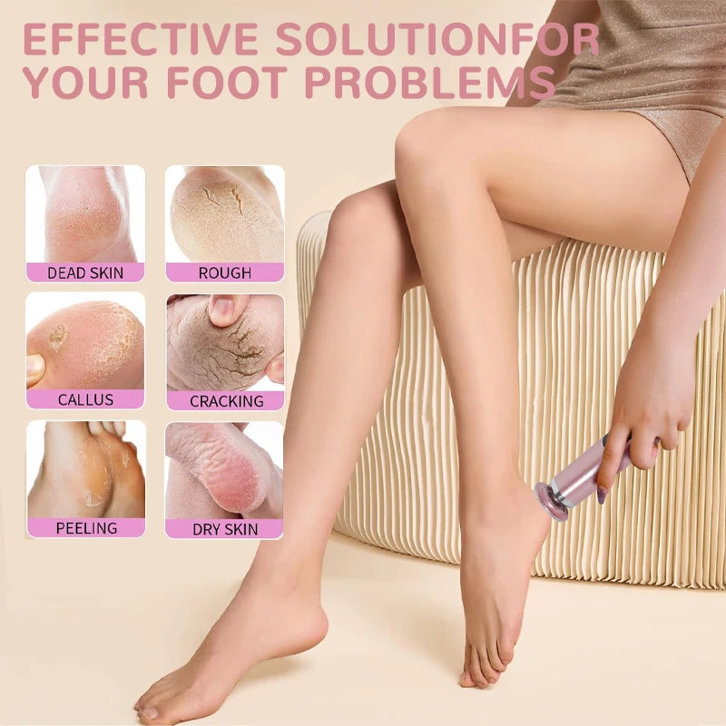 SilkyStep Electric Pedicure Kit